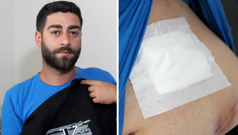 Karnında hissettiği ağrının nedeni röntgende çarpıcı şekilde ortaya çıktı