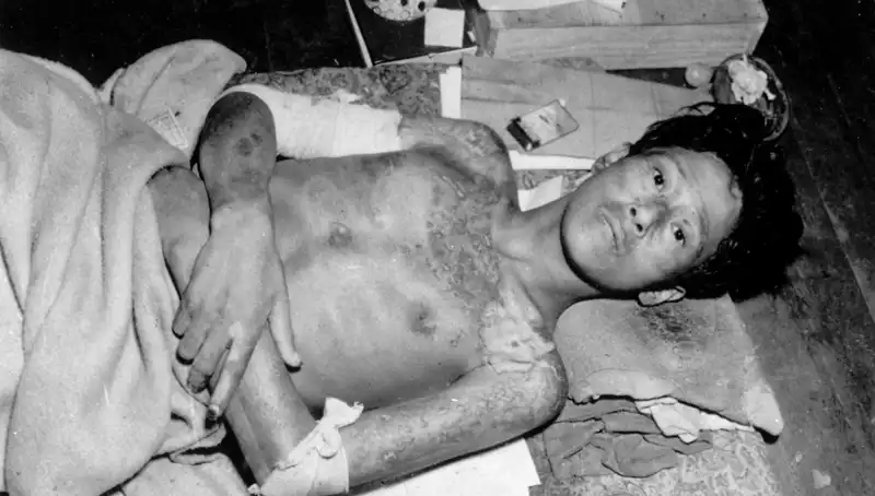 80 Yıl Sonra Nagasaki'den Yükselen Ses: Nükleer Tehdit Endişesi