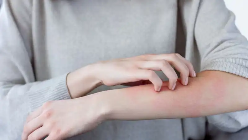 Cilt Kanserinin İki Gizli Belirtisi: Dermatologdan Kritik Uyarılar