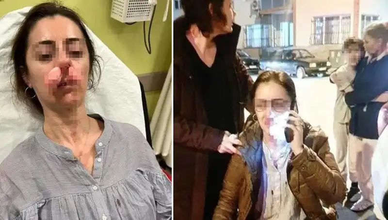 Eşinin Sevgilisi Sandığı Kapı, Şaşırtan Olayla Silah Haline Geldi